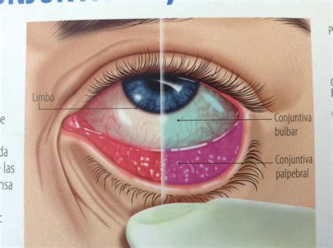 conjuntiva do olho